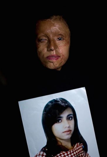 ภาพถ่ายความรุนแรงต่อผู้หญิงในปากีสถาน 